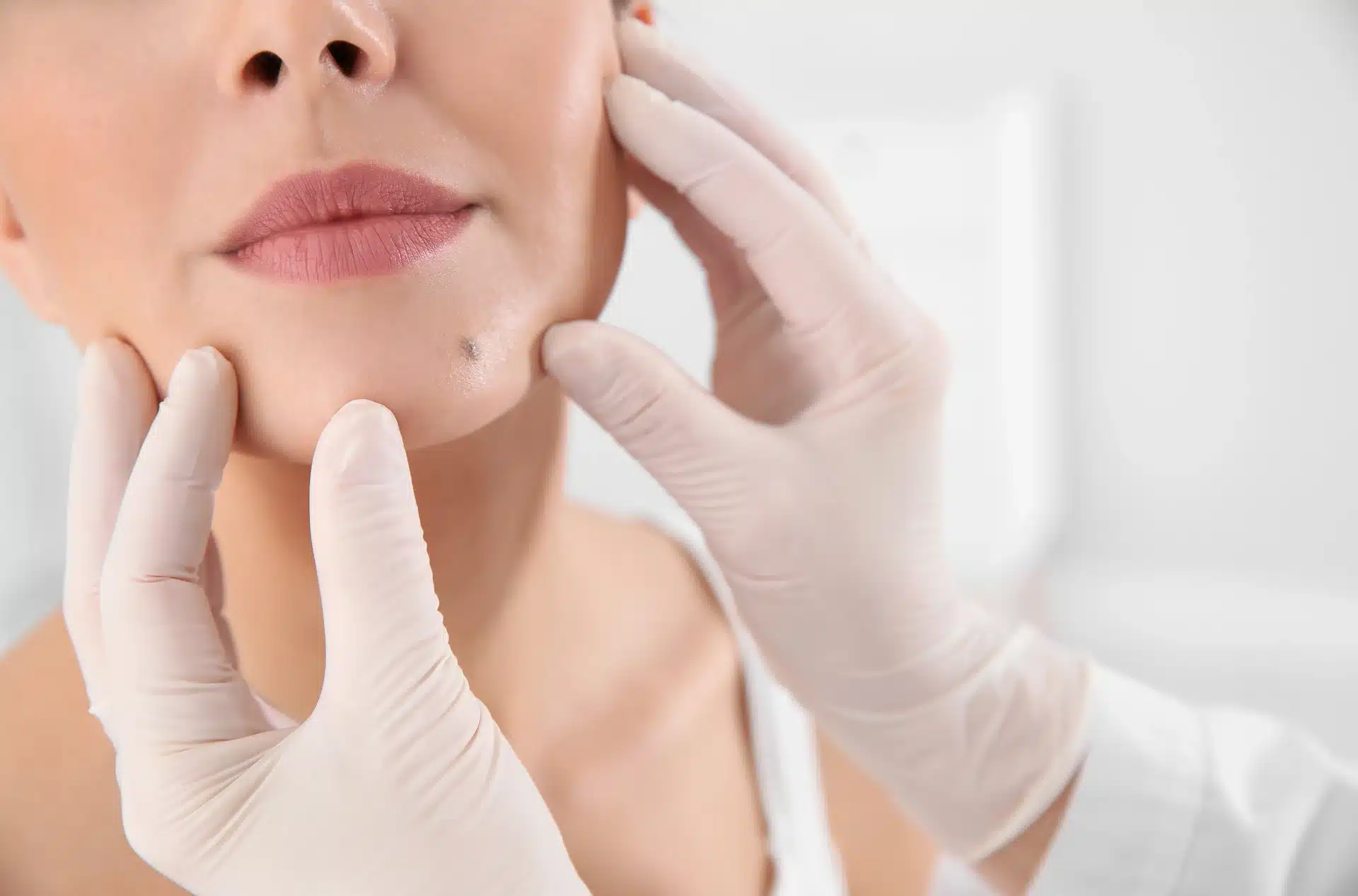 Dermatologist assessment — an essential first step before deciding on skin treatments like Pico laser or chemical peel.